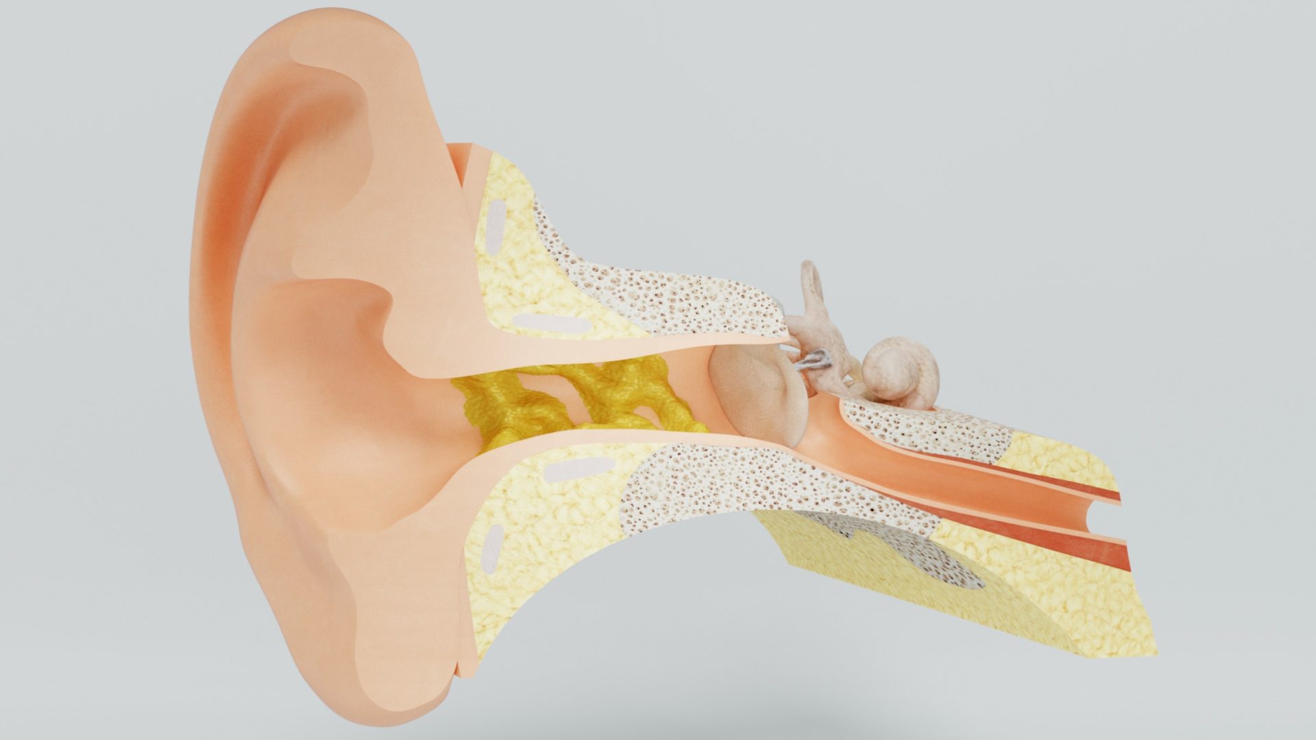 diagram of ear wax in ear